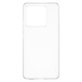 Case X-Ray for Xiaomi Redmi 15 5G, Transparent, PanzerGlass