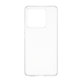 Case X-Ray for Xiaomi 15T Pro 5G, Transparent, CARE