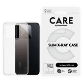 Case X-Ray for Xiaomi 15T Pro 5G, Transparent, CARE